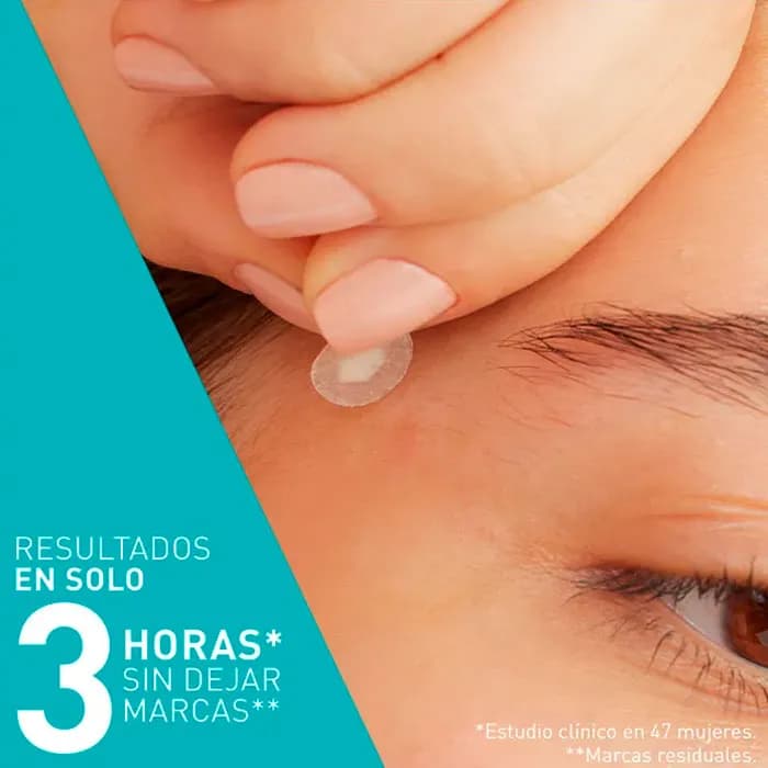 Imagen 2 de Cerave Parches Control Imperfecciones 22 Uds